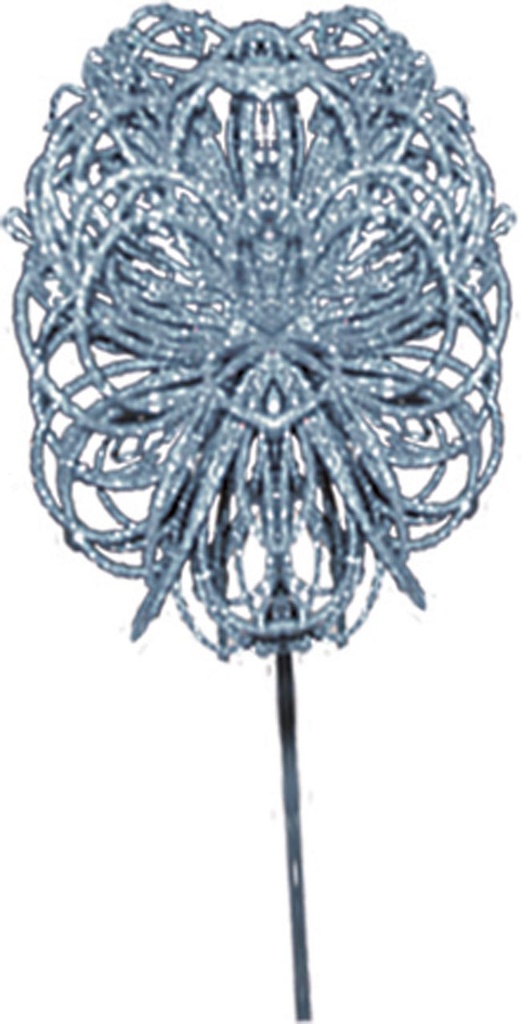 Snowburst Ball Spray, 40cm